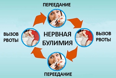 Лечение булимии в Егорьевске